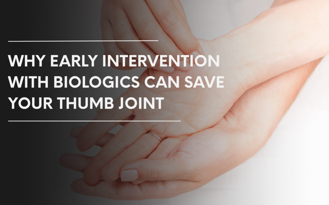 Why Early Intervention with Biologics Can Save Your Thumb Joint