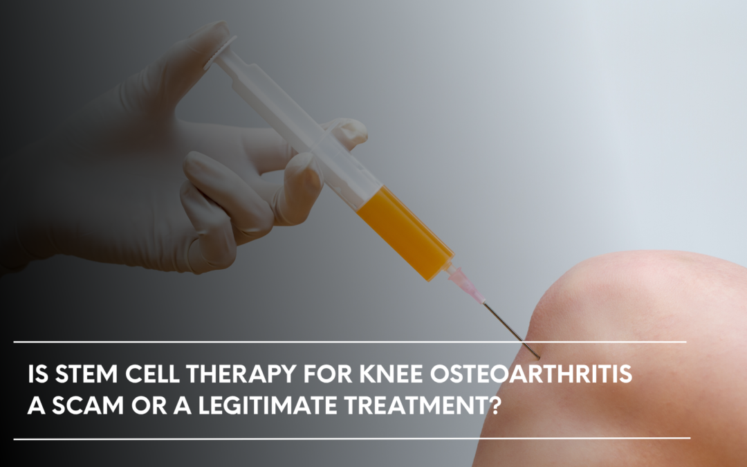 Is Stem Cell Therapy for Knee Osteoarthritis a Scam or a Legitimate Treatment?