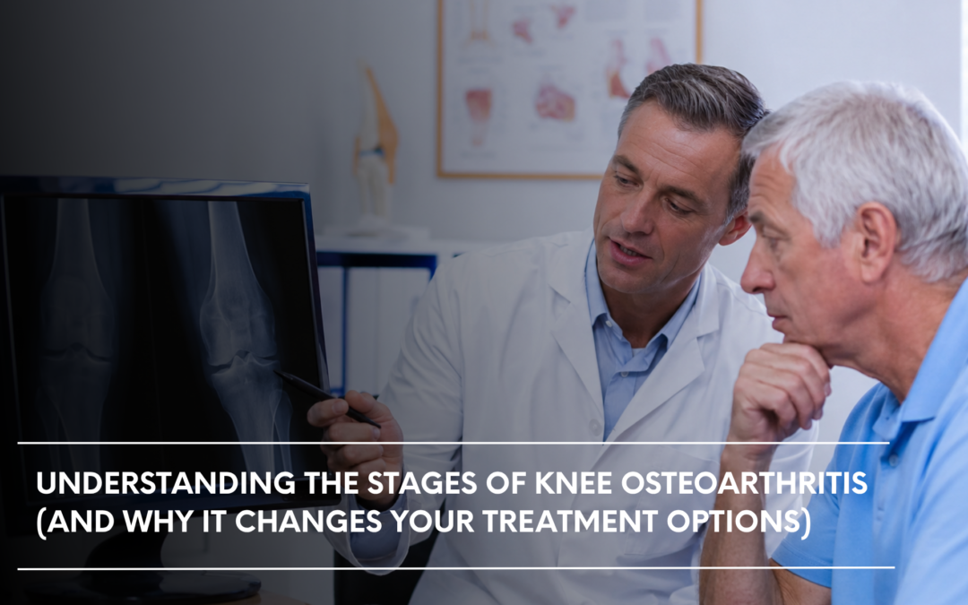 Understanding the Stages of Knee Osteoarthritis (And Why It Changes Your Treatment Options) 